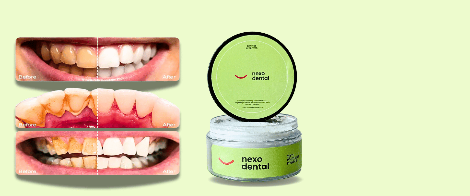 Nexo Dental Care Teeth Whitening Powder product with before and after dental health display on a light green background
