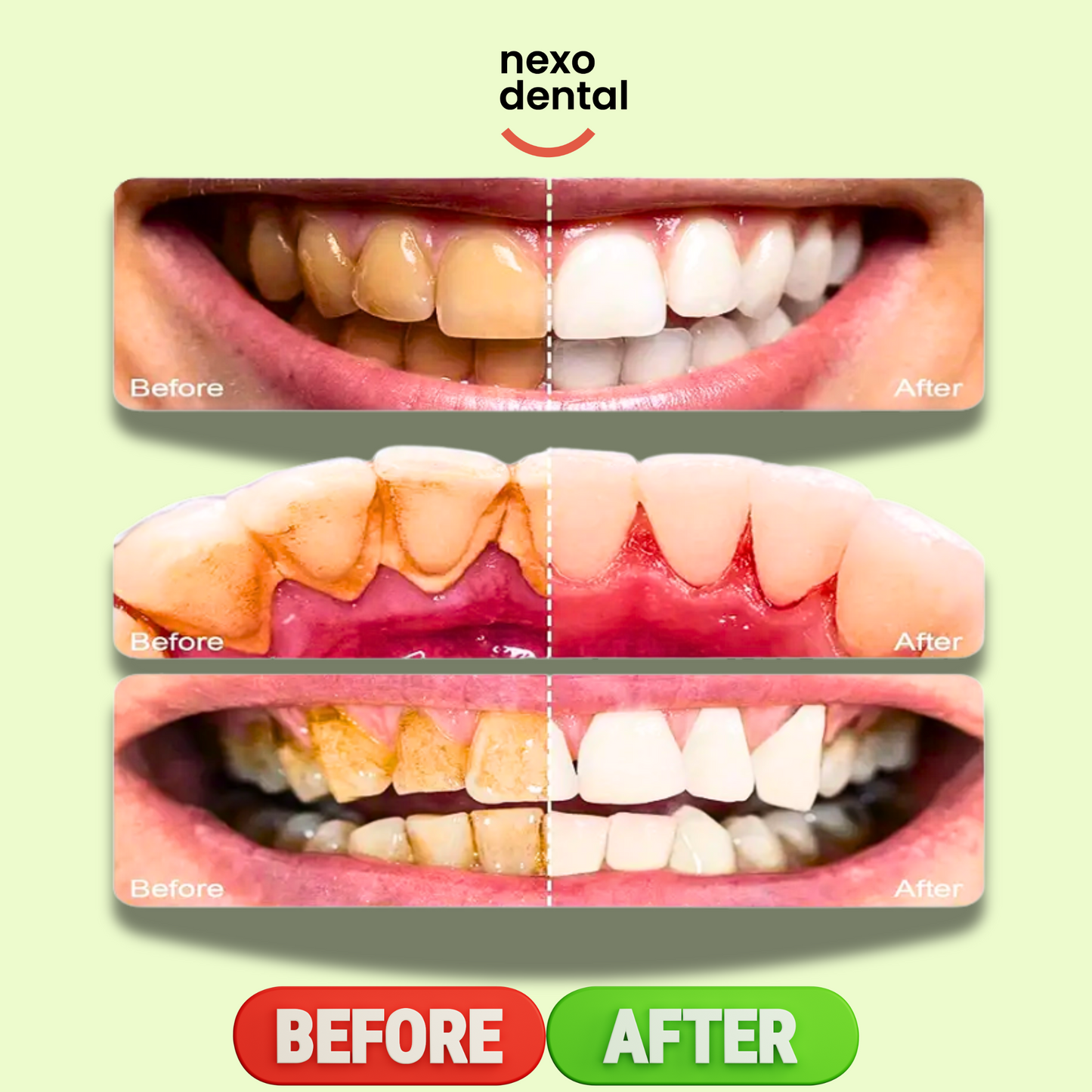 Dentist-Approved Teeth Whitening Powder